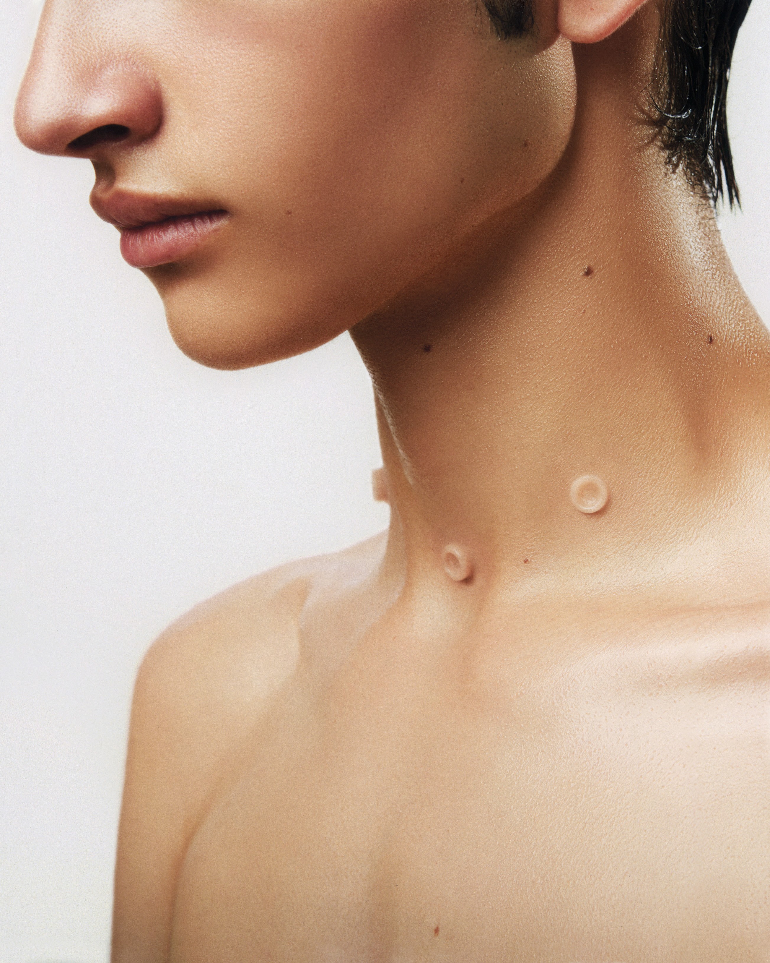 Yuri Roga, project: Snap Implants (fig. 15)